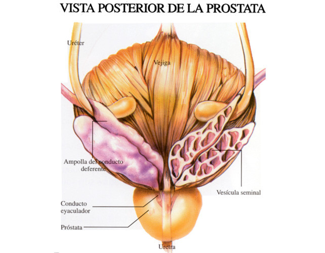 La próstata y sus enfermedades